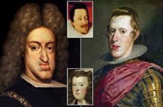 Habsburgo; prognatismo